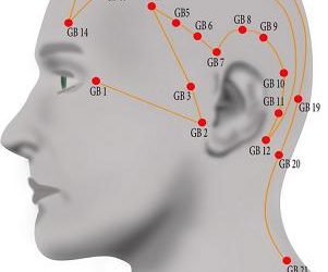 Help for headaches: lifestyle tips to aid your acupuncture treatment